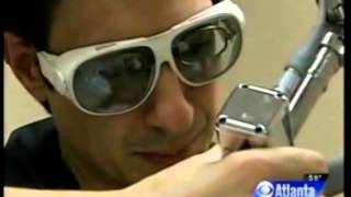 Laser Hair Removal on CBS News