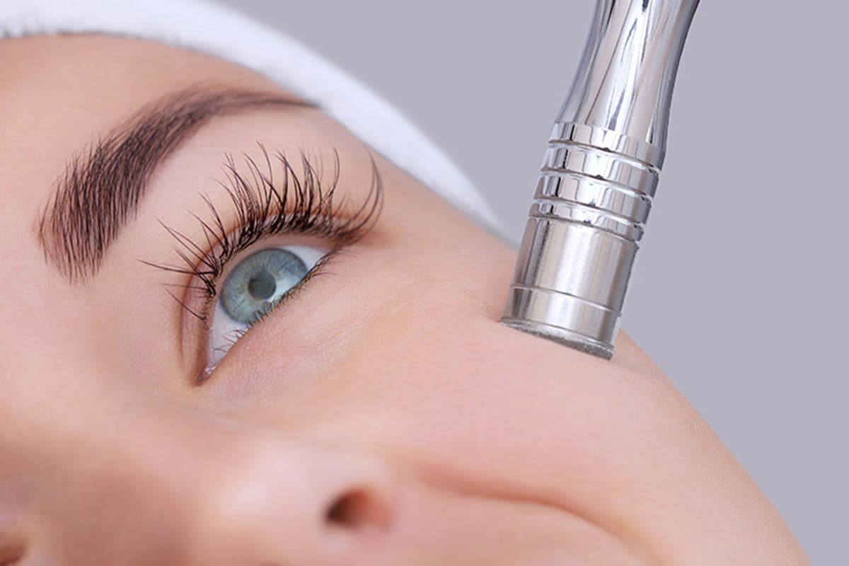 Microdermabrasion in Atlanta, GA Dr. Louis DeJoseph