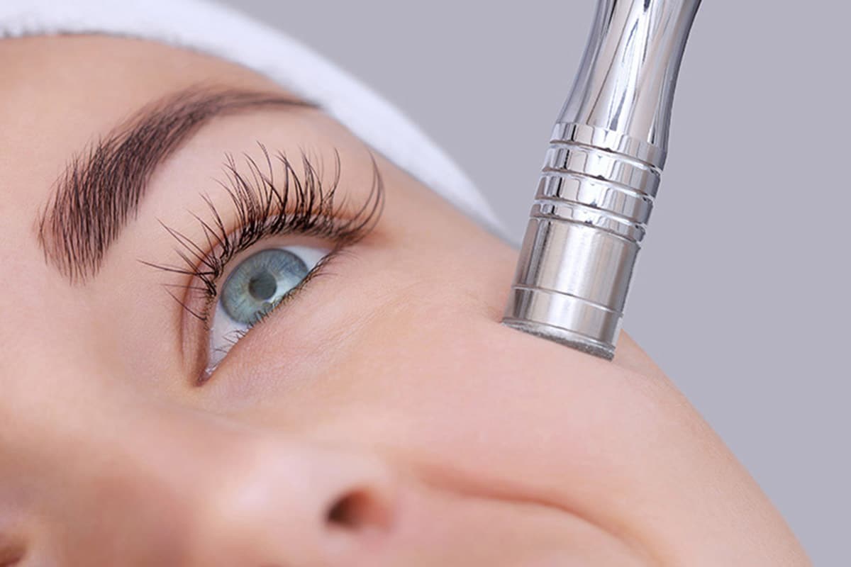 Microdermabrasion Treatment Atlanta Ga