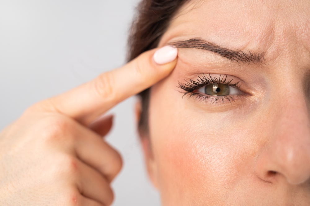 Close-up of woman pressing on eyelid to reduce scarring after surgery.