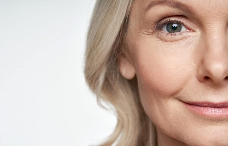 Blepharoplasty significantly improves the appearance of the upper eyelids.