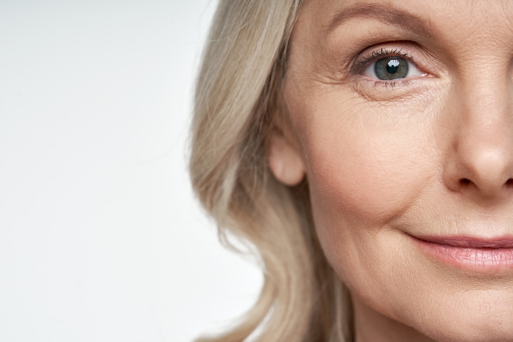 Blepharoplasty significantly improves the appearance of the upper eyelids.