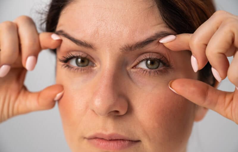 Cost differences exist between upper and lower eyelid surgeries.