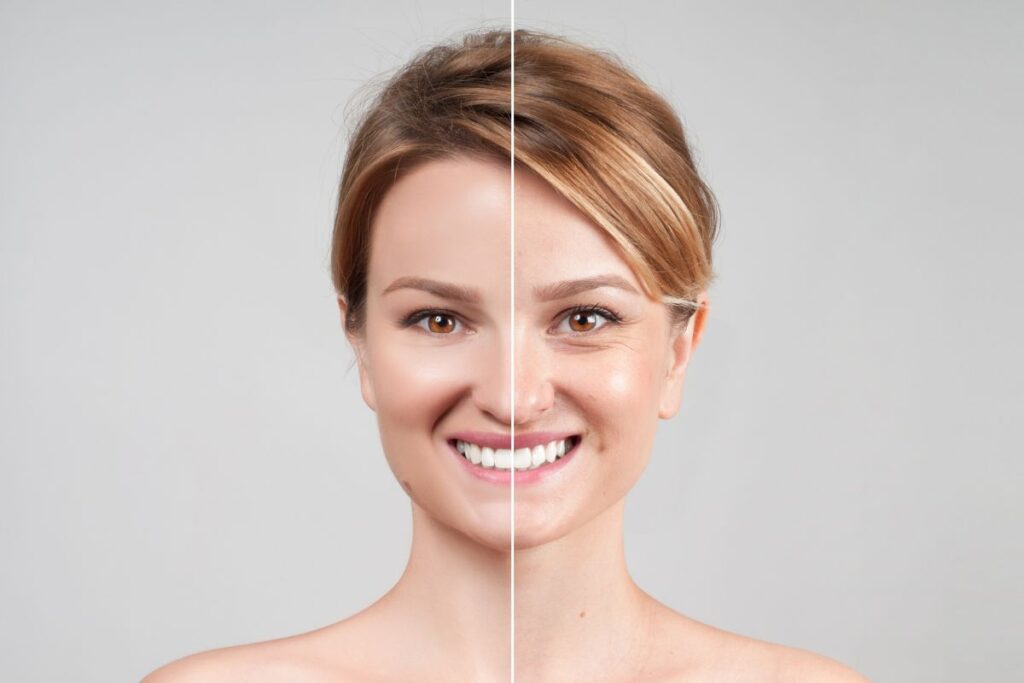 Woman’s face shown with a split view highlighting Botox results, comparing smoother skin to untreated side in her 40s.