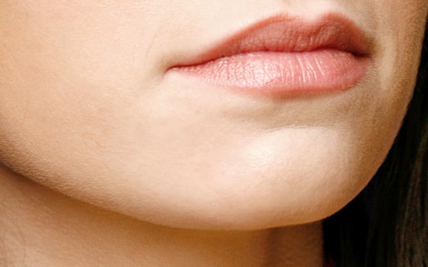 Close-up of lower face with defined jawline, showing contour improvement from Perlane or Radiesse injections.