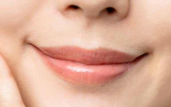 Close-up of a smiling mouth with smooth skin around the nose and lips, showing reduced nasolabial folds.