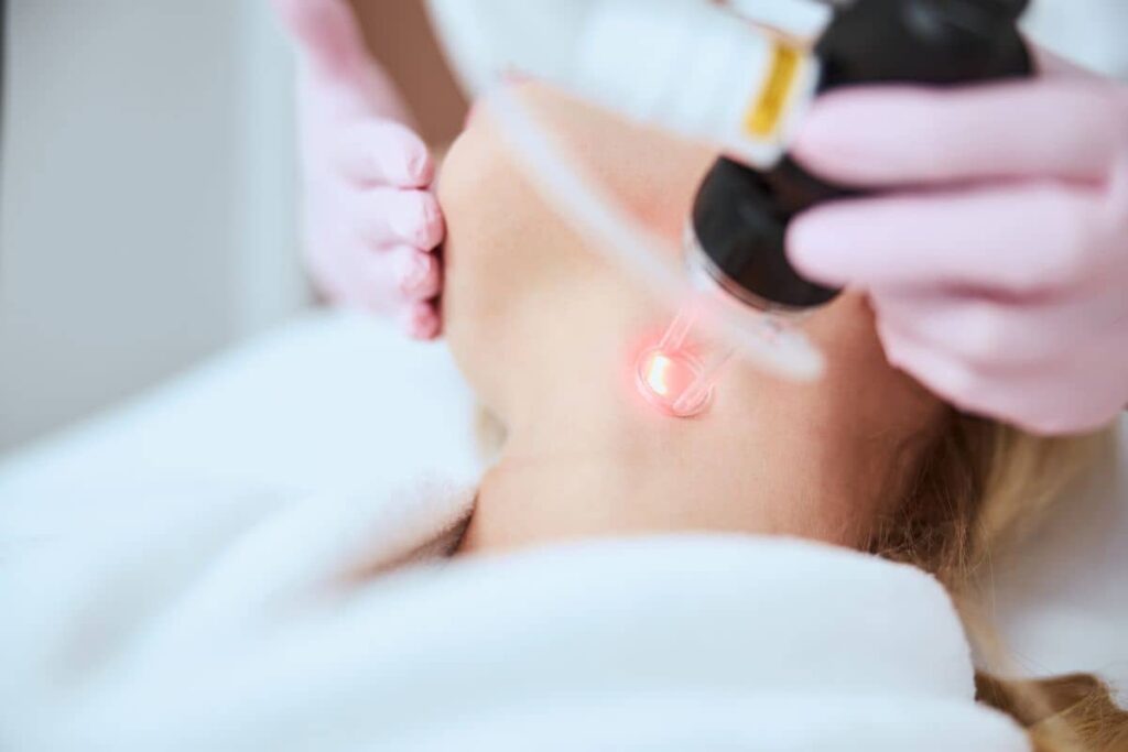 Laser device applied to woman's neck to improve skin tone and texture through non-surgical resurfacing treatment.